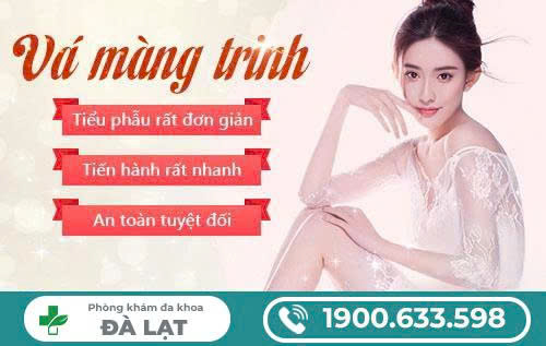 Hình ảnh minh họa